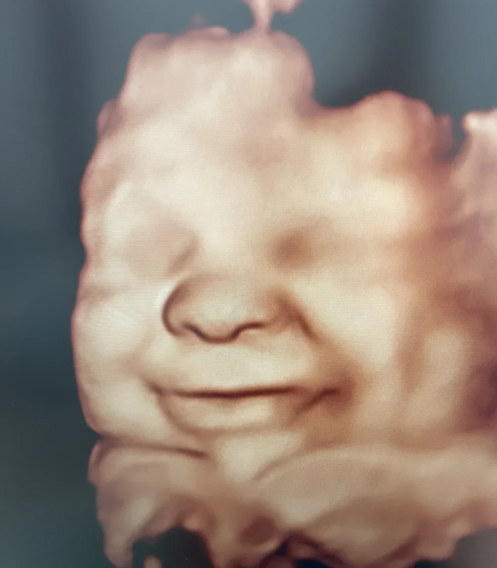 3D ultrasound close-up of a baby's nose and smile