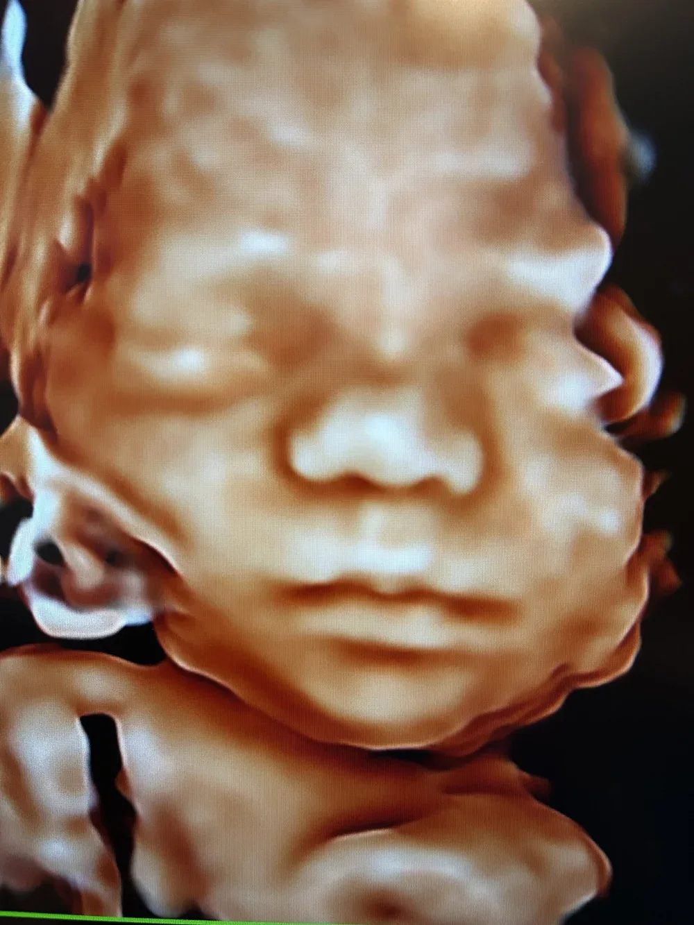 HD 3D ultrasound of a baby's face