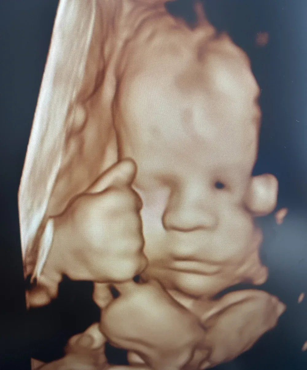 3D ultrasound of a baby with a fist by its face